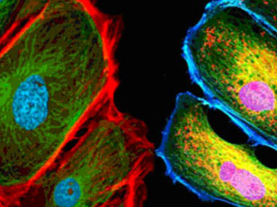 无自发荧光，成像效果佳，可用于荧光显微实验、激光共聚焦显微实验、荧光原位杂交（FISH）和相差显微实验等